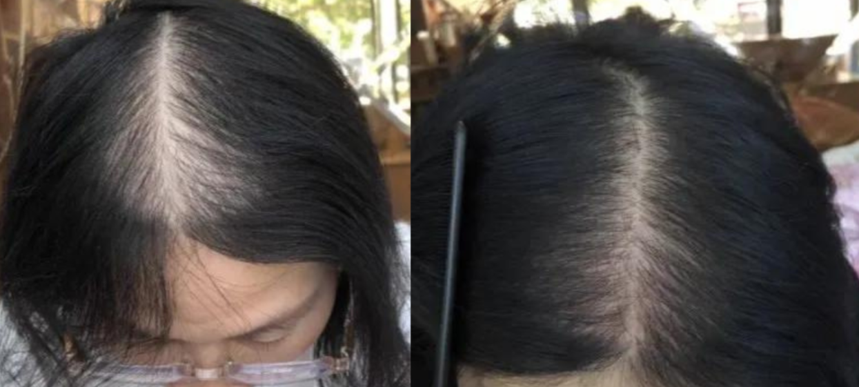 Lustrao Hair Growth Trio